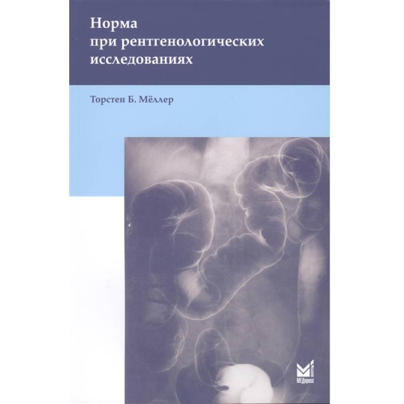 Норма при рентгенологических исследованиях . Мёллер Т.Б. Норма при рентгенологических исследованиях . Мёллер Т.Б.