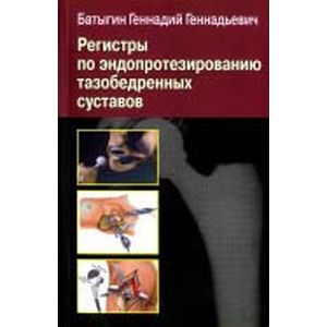 Регистры по эндопротезированию тазобедренных суставов