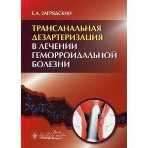 Трансанальная дезартеризация в лечении геморроидальной болезни. Руководство