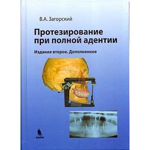 Протезирование при полной адентии