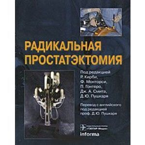 Радикальная простатэктомия
