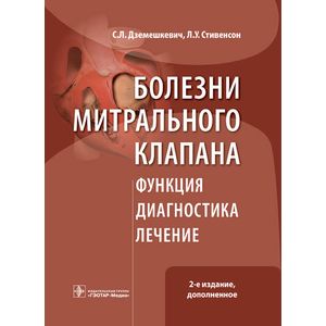 Болезни митрального клапана. Функция, диагностика, лечение