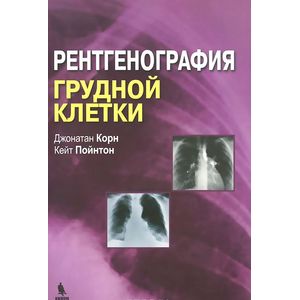 Рентгенография грудной клетки