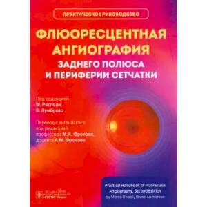 Флюоресцентная ангиография заднего полюса и периферии сетчатки: практическое руководство