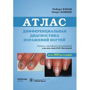 Дифференциальная диагностика поражений ногтей. Атлас