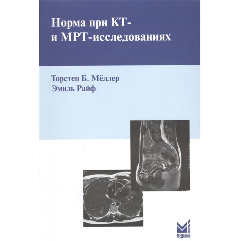 Норма при КТ- и МРТ-исследованиях. Мёллер Т.Б. Норма при КТ- и МРТ-исследованиях. Мёллер Т.Б.