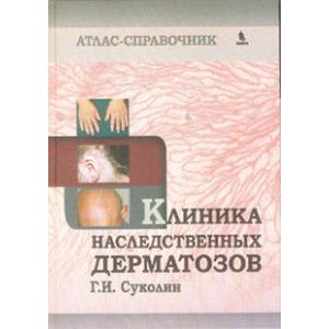 Клиника наследственных дерматозов