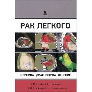 Рак легкого. Клиника, диагностика, лечение
