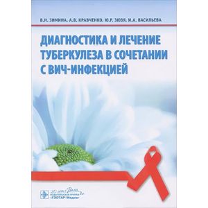 Диагностика и лечение туберкулеза в сочетании с ВИЧ-инфекцией