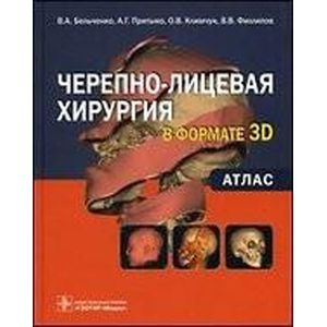 Черепно-лицевая хирургия  в формате 3D:атлас