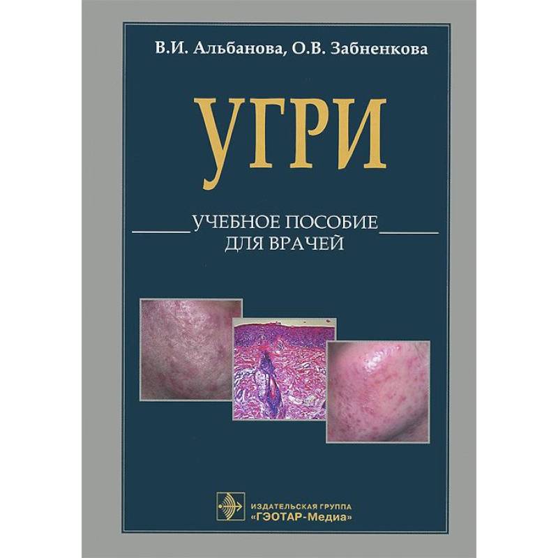 L70. Угри. Учебное пособие для врачей