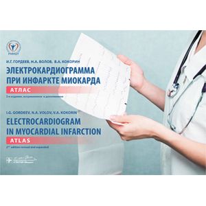 Электрокардиограмма при инфаркте миокарда : Атлас