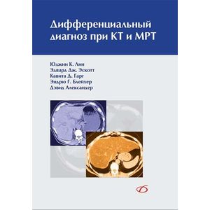Дифференциальный диагноз при КТ и МРТ