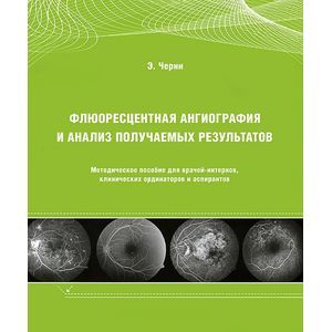 Флюоресцентная ангиография и анализ получаемых результатов. Методическое пособие для врачей-интернов