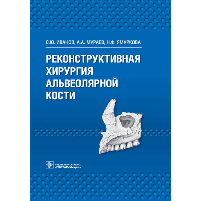 Реконструктивная хирургия альвеолярной кости