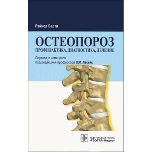 Остеопороз. Профилактика,диагностика,лечение