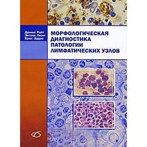 Морфологическая диагностика патологии лимфатических узлов