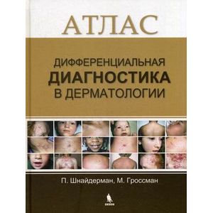 Дифференциальная диагностика в дерматологии