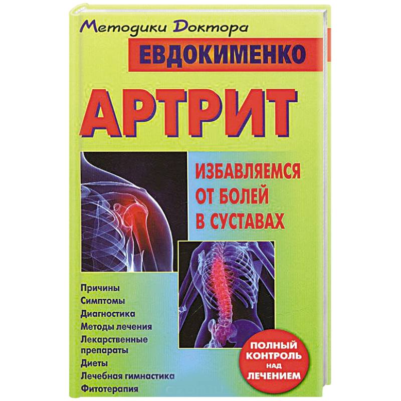 Евдокименко сустава. Артрит книги. Боль в суставах. От боли в суставах. Евдокименко артроз книга.