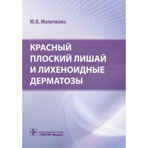 Красный плоский лишай и лихеноидные дерматозы