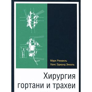 Хирургия гортани и трахеи