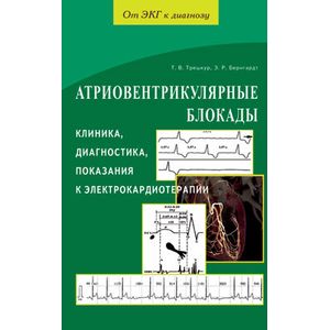 Атриовентрикулярнные блокады. Клиника,диагностика,показания к электрокардиотерапии Атриовентрикулярнные блокады. Клиника,диагностика,показания к электрокардиотерапии
