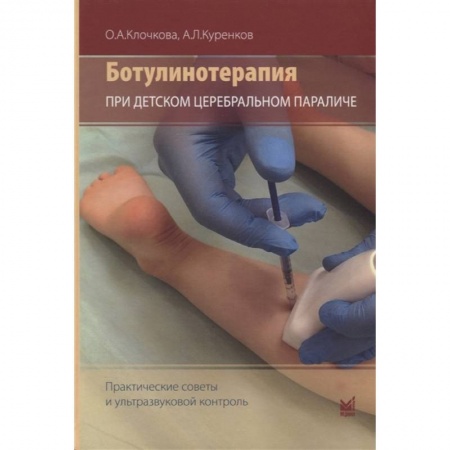 Отдельные виды заболеваний у детей, книга Ботулинотерапия при детском церебральном параличе: практические советы и ультразвуковой контроль купить по низкой цене