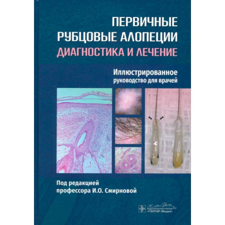 Кожные и венерические болезни, книга Первичные рубцовые алопеции. Диагностика и лечение. Иллюстрированное руководство для врачей купить по низкой цене