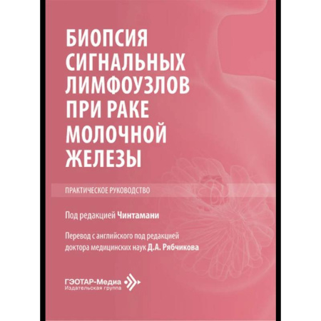 Онкология, книга Биопсия сигнальных лимфоузлов при раке молочной железы: практическое руководство купить по низкой цене