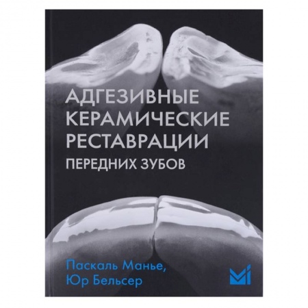 Стоматология, книга Адгезивные керамические реставрации передних зубов купить по низкой цене