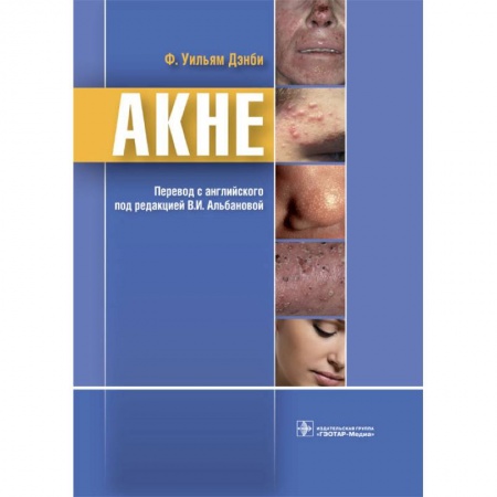 Диагностика и лечение, книга Акне купить по низкой цене