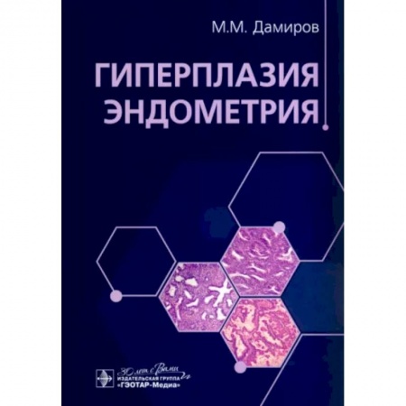 Акушерство и гинекология, книга Гиперплазия эндометрия купить по низкой цене