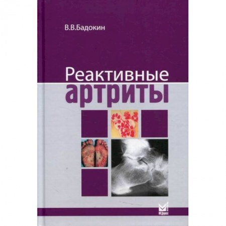 Другие виды специальной медицины, книга Реактивные артриты. Урогенитальные и постэнтероколитические купить по низкой цене