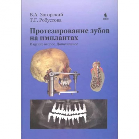 Стоматология, книга Протезирование зубов на имплантатах купить по низкой цене