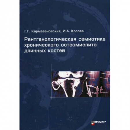 УЗИ. ЭКГ. Томография. Рентген, книга Рентгенологическая семиотика хронического остеомиелита длинных костей купить по низкой цене