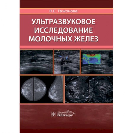 Диагностика и лечение, книга Ультразвуковое исследование молочных желез купить по низкой цене