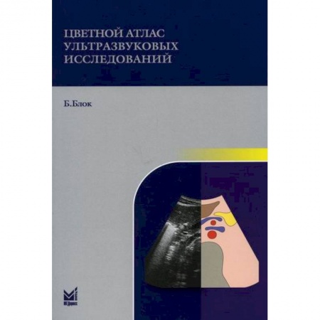 УЗИ. ЭКГ. Томография. Рентген, книга Цветной атлас ультразвуковых исследований купить по низкой цене
