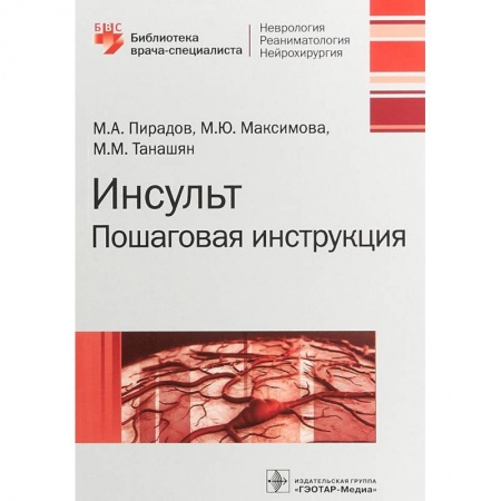 Неврология, книга Инсульт. Пошаговая инструкция. Руководство купить по низкой цене