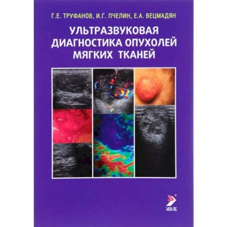 УЗИ. ЭКГ. Томография. Рентген, книга Ультразвуковая диагностика опухолей мягких тканей купить по низкой цене