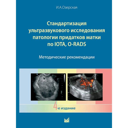 УЗИ. ЭКГ. Томография. Рентген, книга Стандартизация ультразвукового исследования патологии придатков матки по IOTA, O-RADS. Методические рекомендации. 4-е издание купить по низкой цене