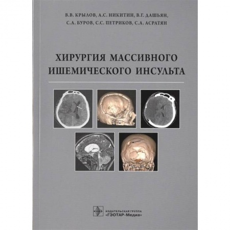 Хирургия. Ортопедия, книга Хирургия массивного ишемического инсульта купить по низкой цене
