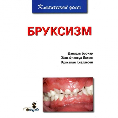 Стоматология, книга Бруксизм купить по низкой цене