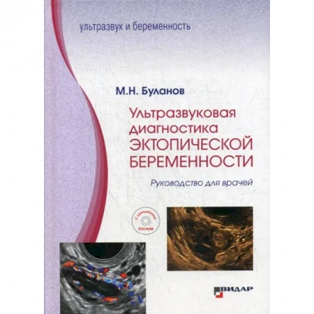 УЗИ. ЭКГ. Томография. Рентген, книга Ультразвуковая диагностика эктопической беременности купить по низкой цене