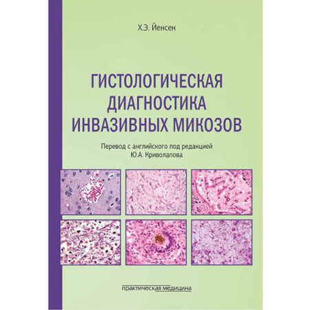Гистология. Эмбриология. Цитология, книга Гистологическая диагностика инвазивных микозов купить по низкой цене