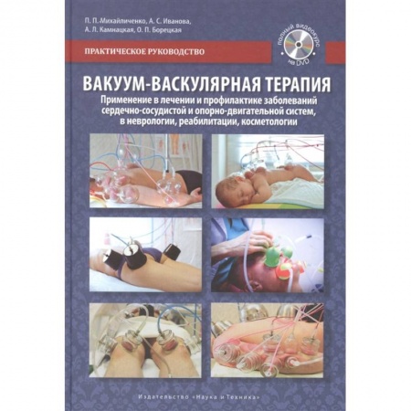 Косметология. Парфюмерия, книга Вакуум-васкулярная терапия. Применение в лечении и профилактике заболеваний сердечно-сосудистой и опорно-двигательной систем, в неврологии, реабилитации, косметологии (+DVD) купить по низкой цене