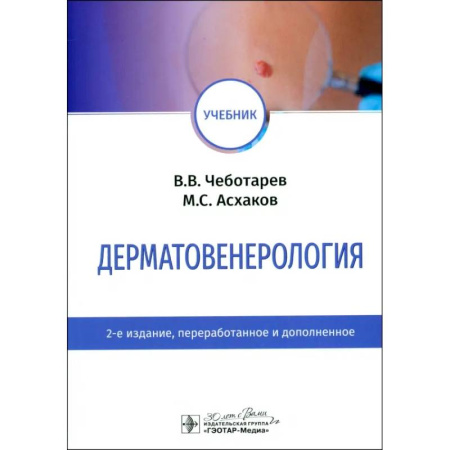 Кожные и венерические болезни, книга Дерматовенерология. Учебник купить по низкой цене