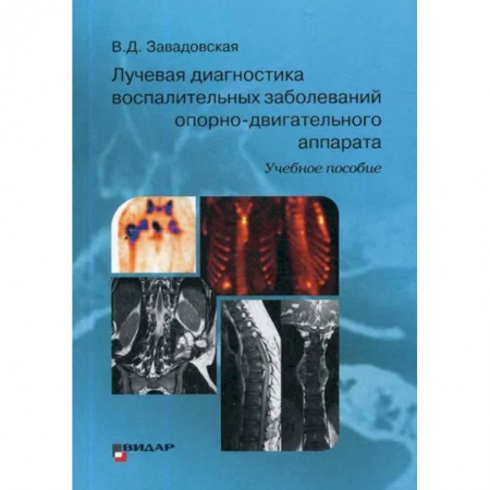 УЗИ. ЭКГ. Томография. Рентген, книга Лучевая диагностика воспалительных заболеваний опорно-двигательного аппарата купить по низкой цене