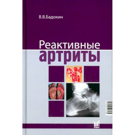 Медицинские энциклопедии и справочники, книга Реактивные артриты. Урогенитальные и постэнтероколитические купить по низкой цене