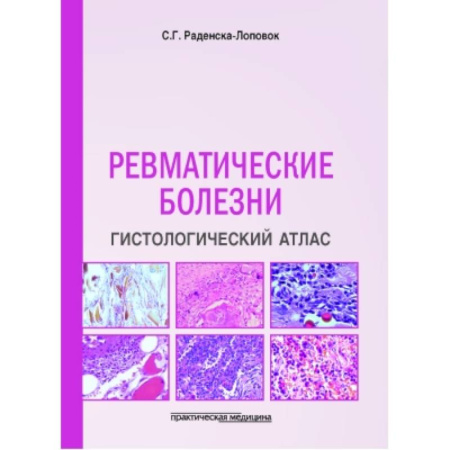 Медицинские энциклопедии и справочники, книга Ревматические болезни. Гистологический атлас купить по низкой цене