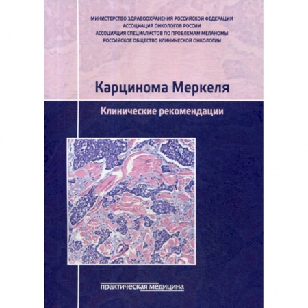 Онкология, книга Карцинома Меркеля. Клинические рекомендации купить по низкой цене